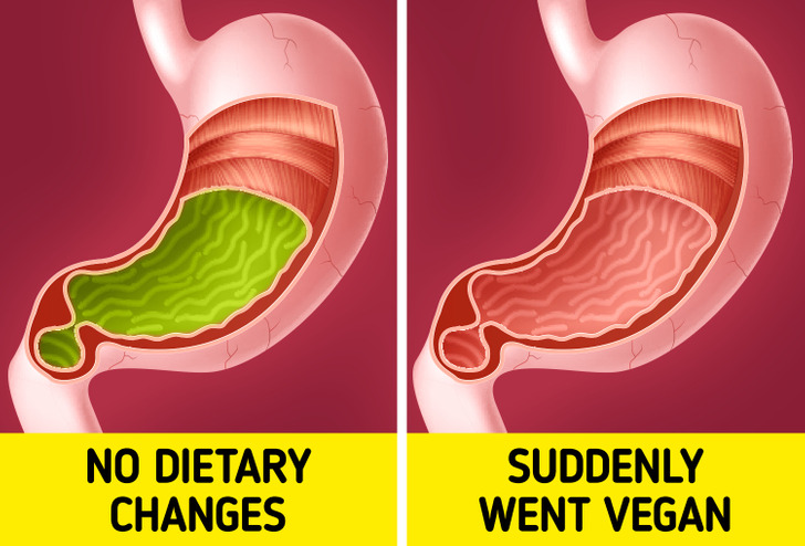 Stop Eating Meat Side Effects