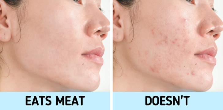 Stop Eating Meat Side Effects